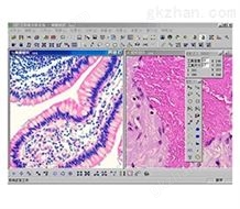 专业颗粒分析软件MIAS