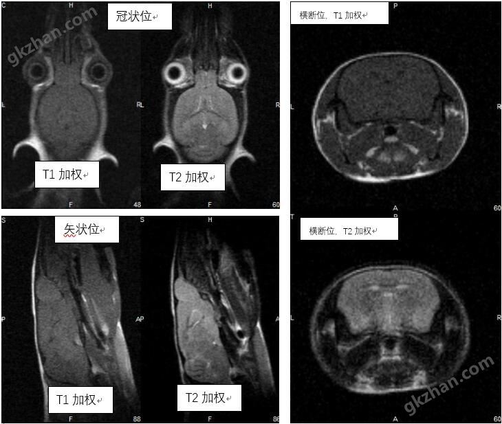 M3小动物核磁共振成像系统默认参数下普通老鼠软组织成像